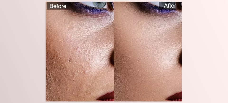 SkinFiner - Automatic skin smoothing